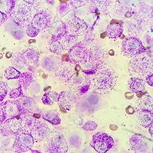 mast-cells-immune-system-winter-300x300
